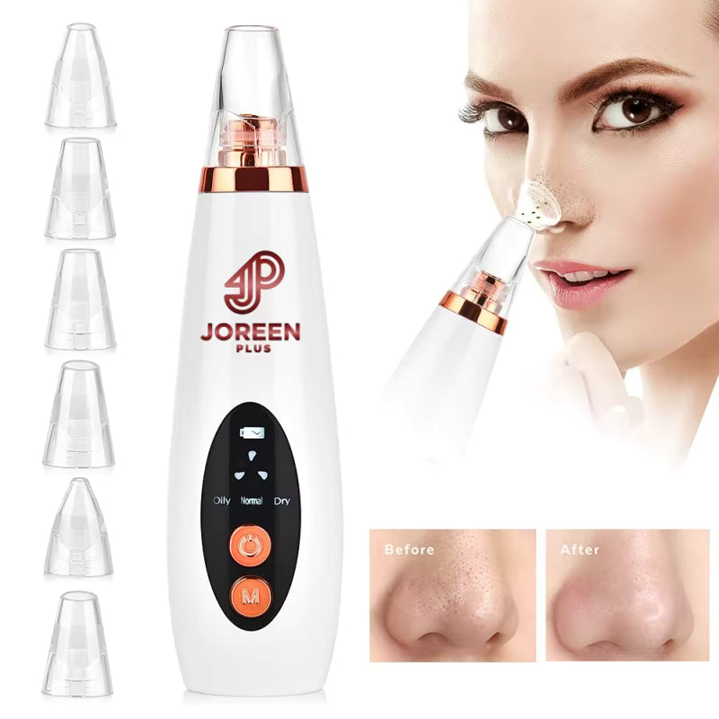 VeraLume Electric Blackhead Remover Vacuum