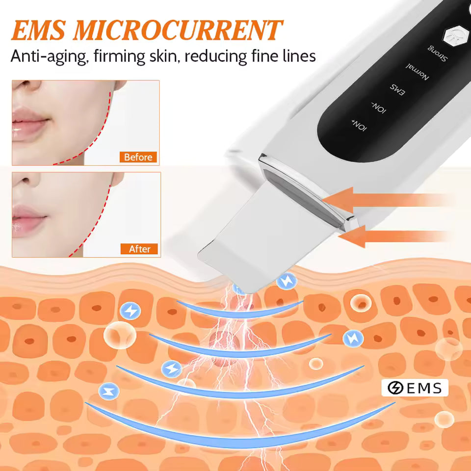 VeraLume Ultrasonic Facial Cleanser — 4-in-1 Ion & LED Skin Scrubber